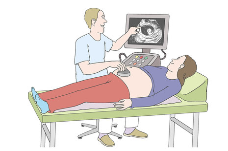 Grafik: Frau liegt auf Liege beim Arzt und lässt einen Ultraschall machen.