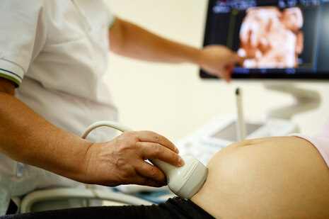 Ein Mediziner nimmt bei einer Schwangeren eine Ultraschalluntersuchung am Bauch vor und zeigt ihr am Monitor etwas